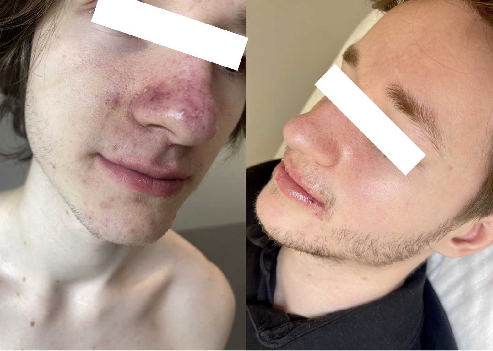 Пример работы Полины Жоголевой: сравнение фотографий 2