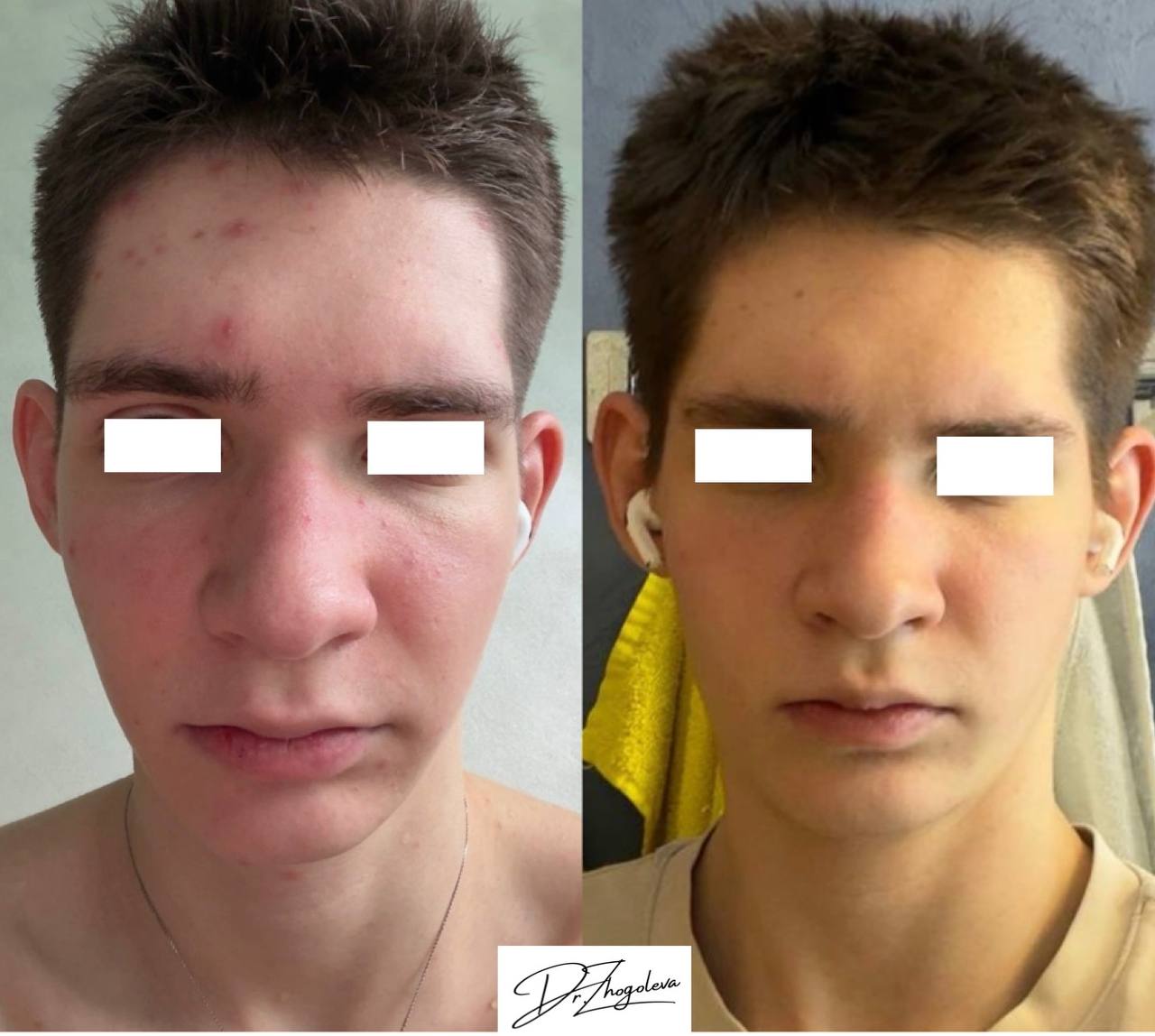 Пример работы Полины Жоголевой: сравнение фотографий 9